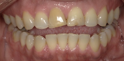 Julia's Case before treatment